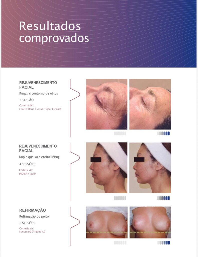 Tratamento Corpo (20)