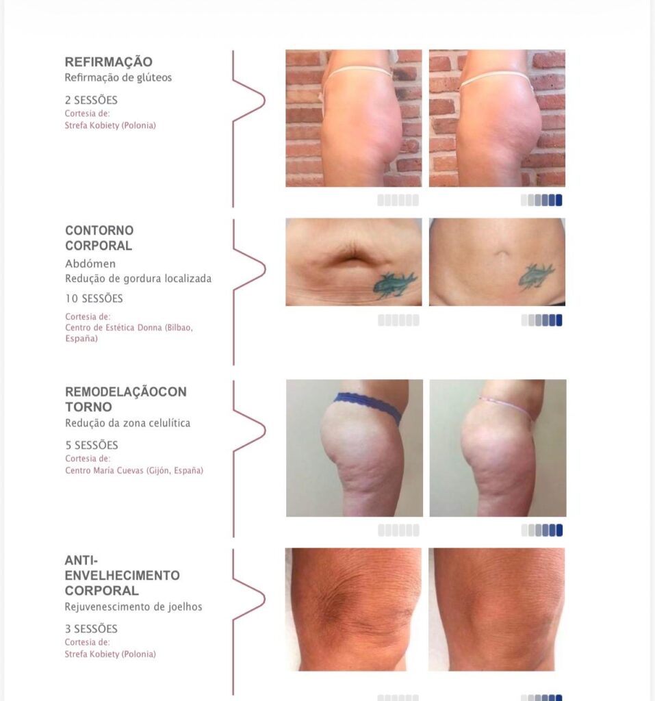 Tratamento Corpo (21)
