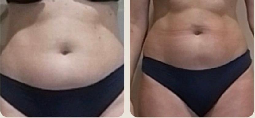 Tratamento Corpo (22)