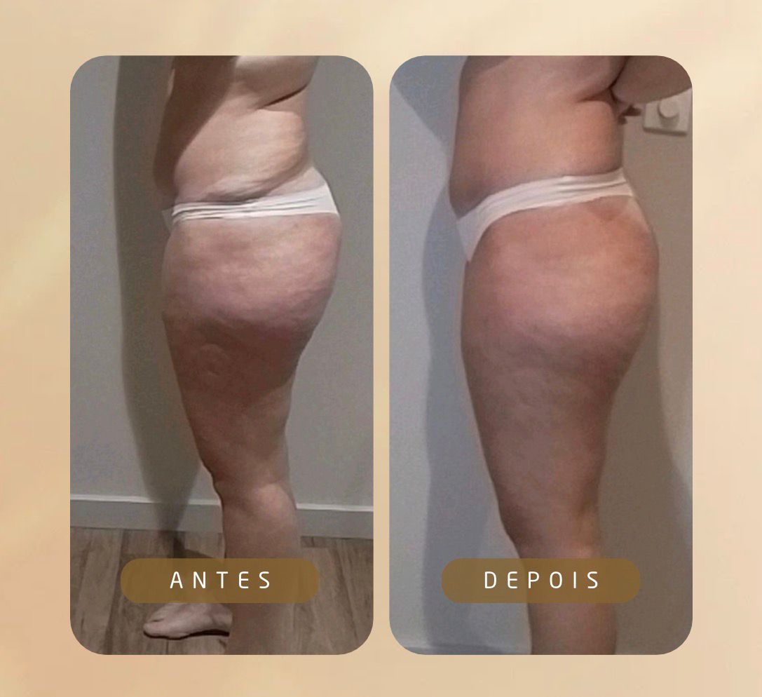 Corpo (1)